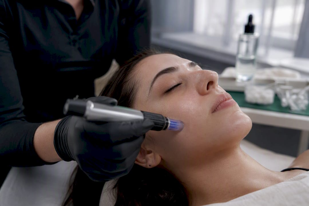 Close-up of microneedling device on skin